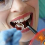 Zahnbleaching - wie sinnvoll ist es?