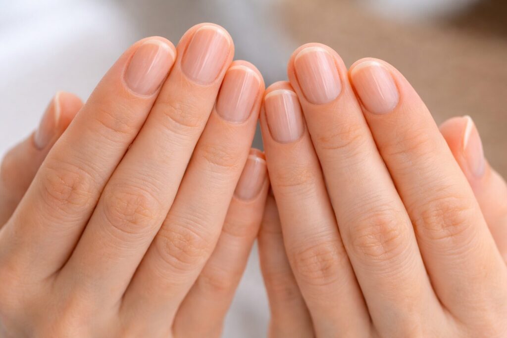 Längsrillen an den Nägeln