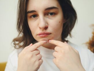 Hormonelle Akne